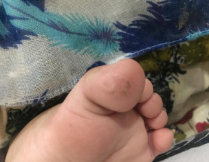 Skin Problem 