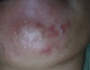 Skin Problem.