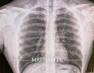Xray Consultation