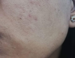 Skin Condition 