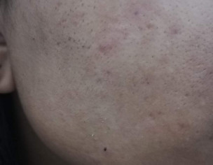 Skin Condition 