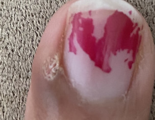 Hand Finger Problem
