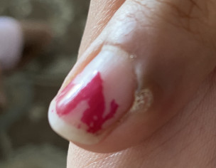 Hand Finger Problem