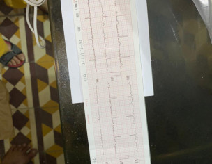 Heart Problem