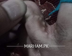 Skin Problem