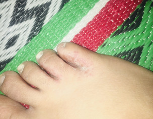 Skin Problem
