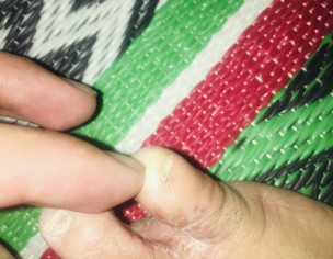 Skin Problem