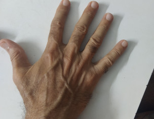 Skin Problem