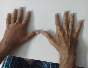 Skin Problem