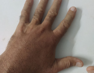Skin Problem