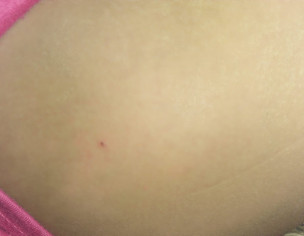 Allergic Problem