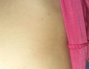 Allergic Problem
