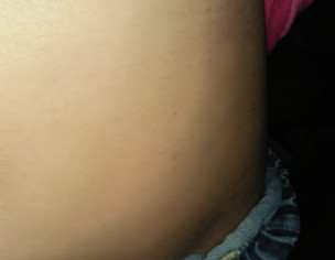 Allergic Problem