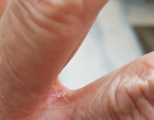 Dermatoloist