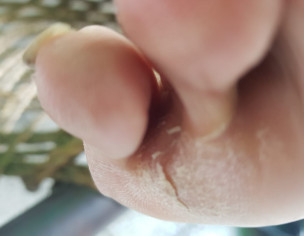 Dermatoloist