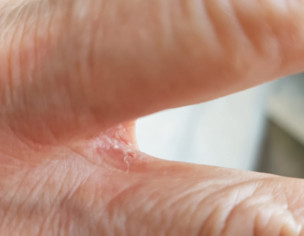 Dermatoloist