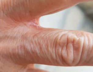 Dermatoloist