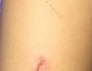 Dermatologist Issue