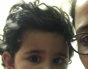 Eyes Issue
