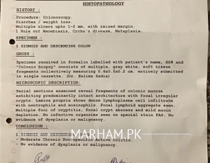 Colonoscopy Report