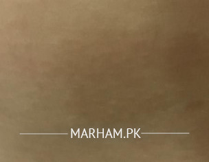 Skin Issue!