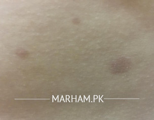 Skin Issue!