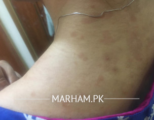 Skin Issue!