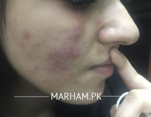 SKIN (Dermatology)