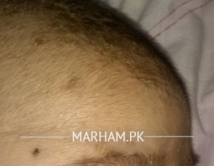 Skin Problem