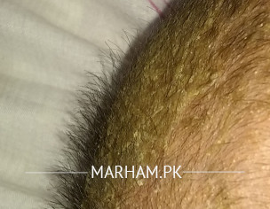 Skin Problem