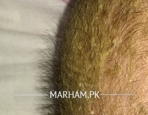 Skin Problem