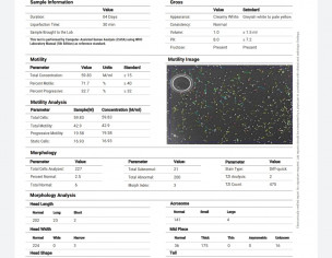 Semen Analysis