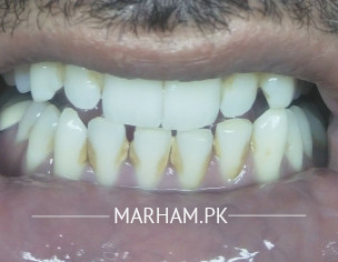Dental Problem
