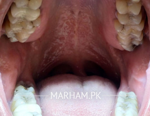 Dental Problem