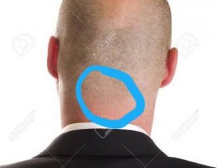 Back Of Head 