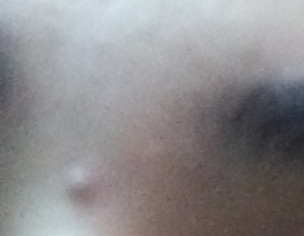 Skin Problems 