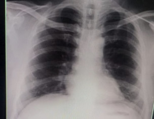 Covid Patient 