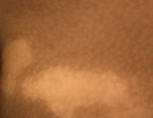 White Patches