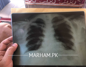 X Ray Review