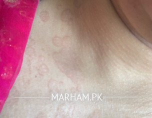 Skin Problem 