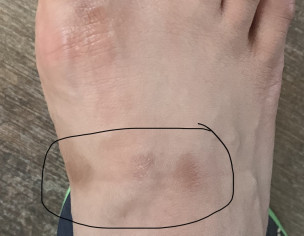Dermatology