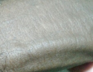 Extra Vein