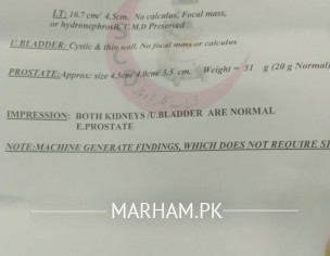 Kidney Issue