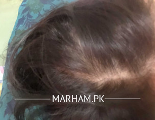 Thin Weak Hair
