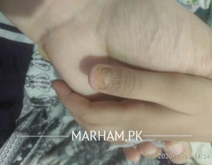 Nail