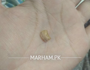 Nail