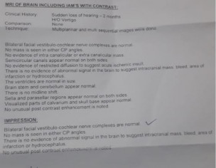 Hearing Loss