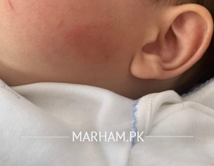 Skin Problem