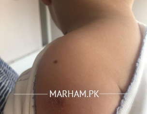 Skin Problem