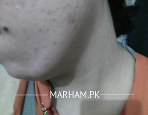 Skin Problem